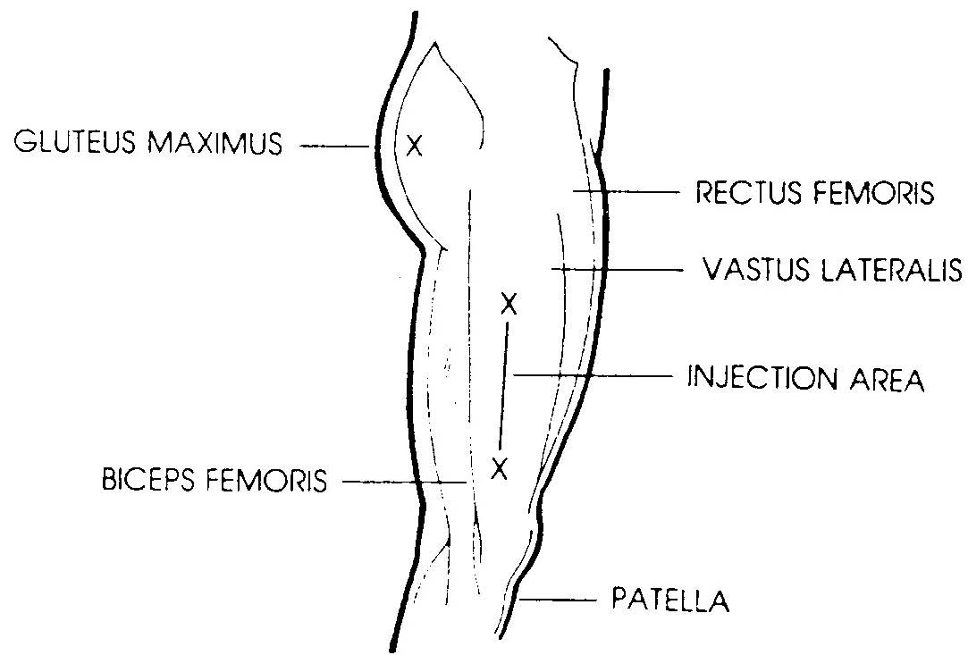 Injection Site