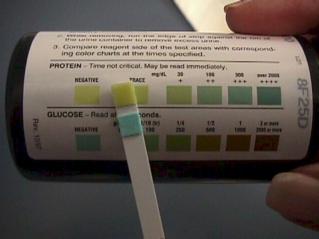 What is a healthy range of protein in urine?