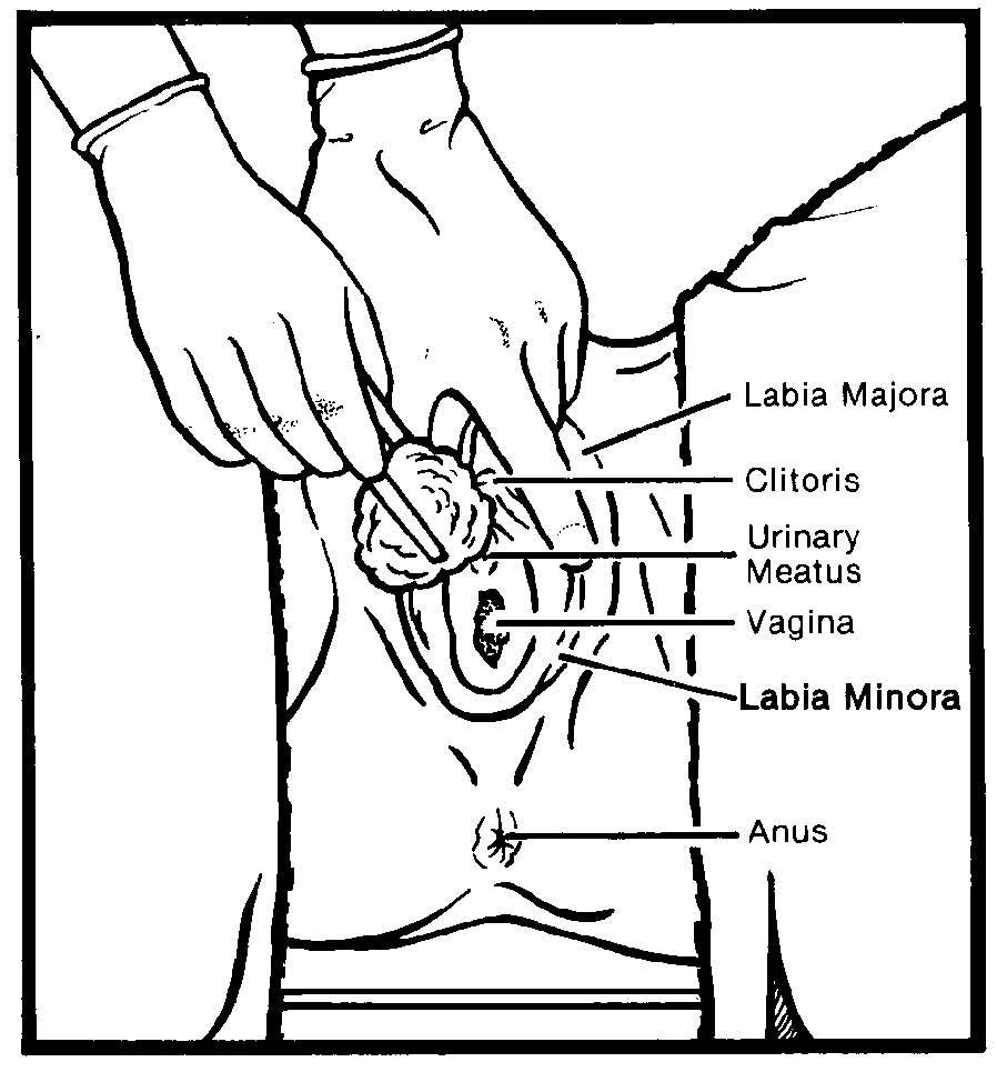 How do you insert a catheter?