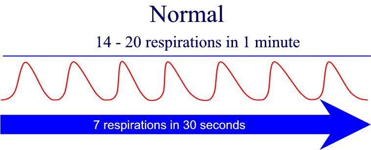 Normal Adult Breathing Rate 86
