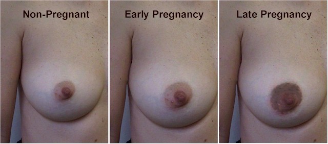 areola during pregnancy pictures