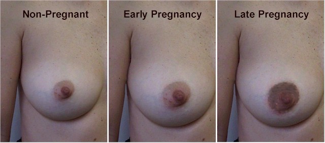 Areolas When Pregnant 52