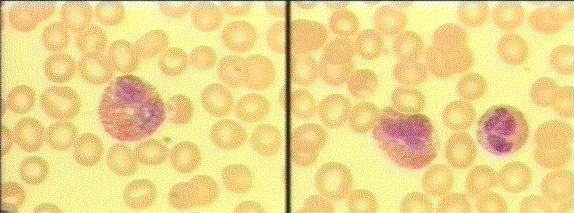 eosinophils