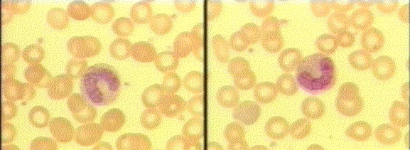 band cells