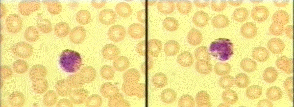 basophils
