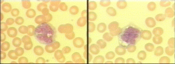 monocytes