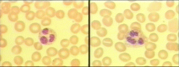 segmented neutrophils
