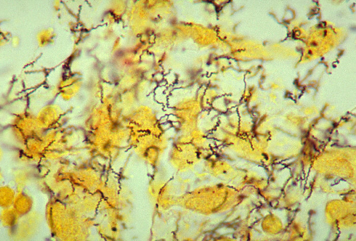 spirochetes