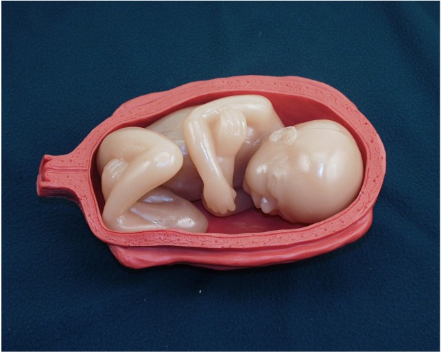 Complete Breech