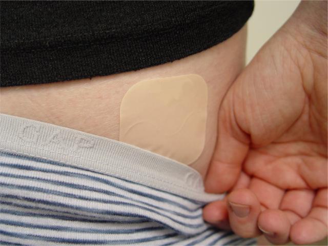 The contraceptive patch may be worn anywhere, but typically is placed in an area covered by the panties. This provides both a discrete area and some degree of protection against the patch becoming dislodged.