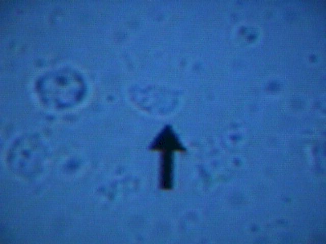 Trichomonas is best seen on the Normal Saline slide.