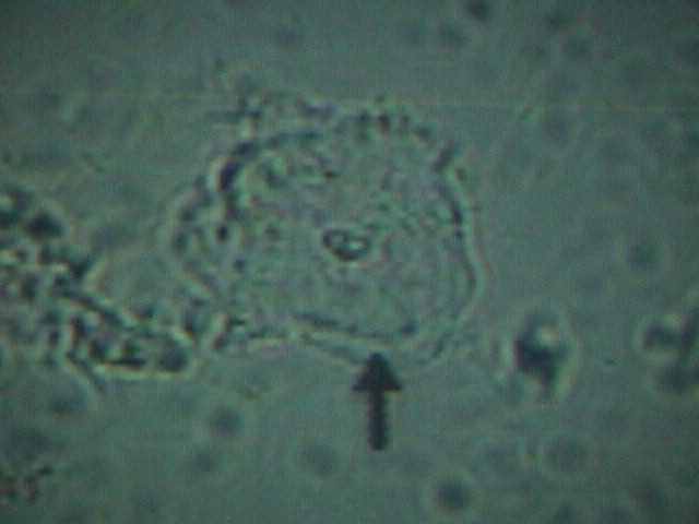 Normal vaginal epithelial cell