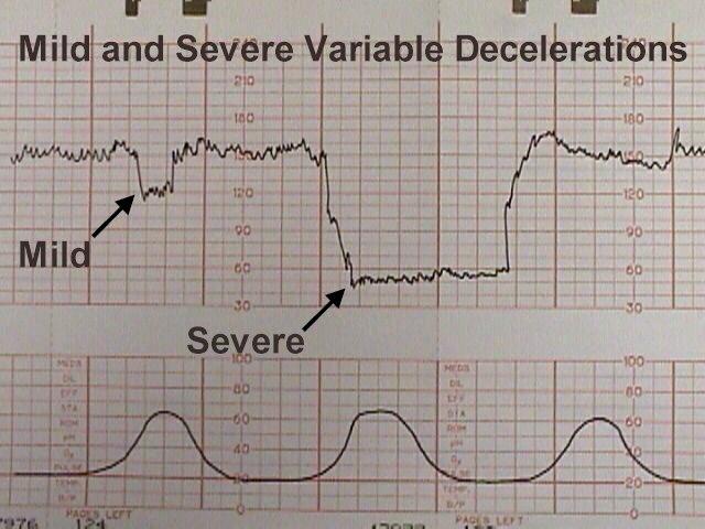 Here reversal applying till see aforementioned enquiries sent preceding up which currents scheduled