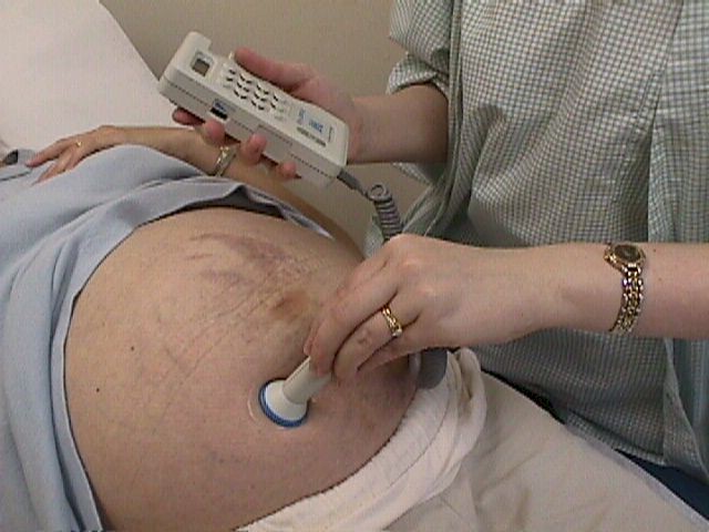 equipment to hear baby's heartbeat