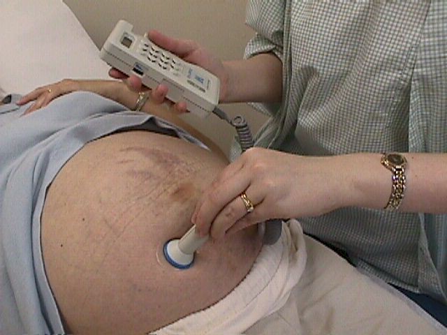 fetal heart rate doppler