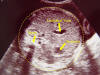 labled abdomen