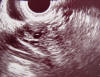 ovary