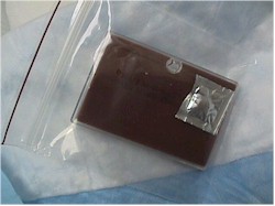 Chocolate Agar