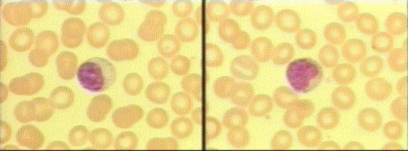 Lymphocytes (Lymphs)