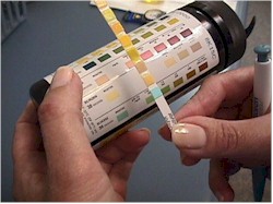 Reading a urine dipstick test