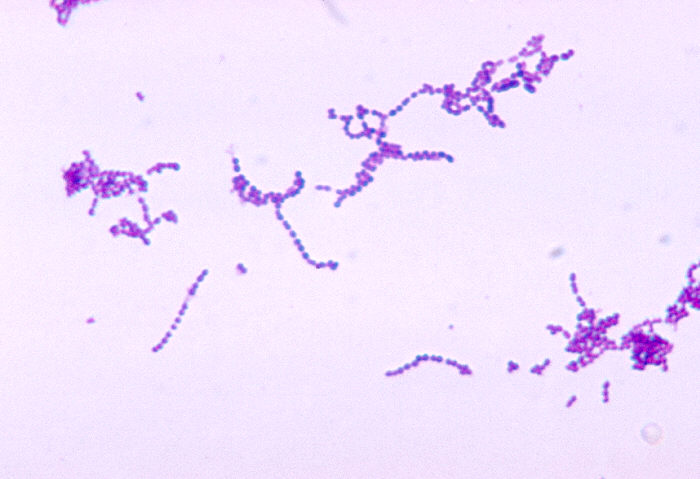Microscopic view of Group B Strep (GBS)