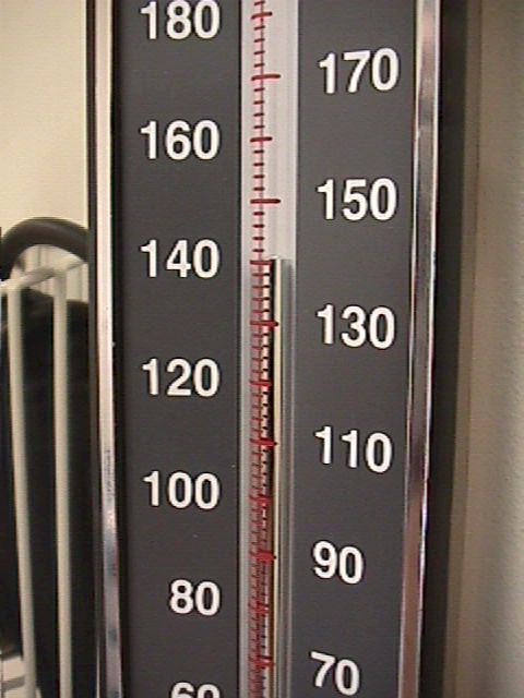 Systolic blood pressure of 140