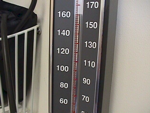 Severe pre-eclampsia is associated with blood pressures in excess of 160/110