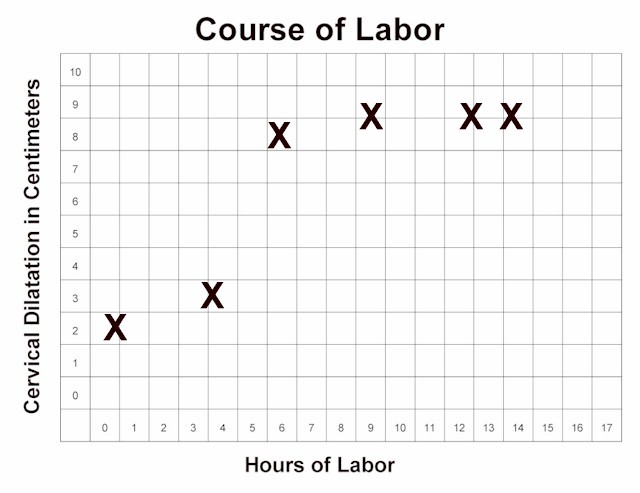 Arrest of Active Labor Curve