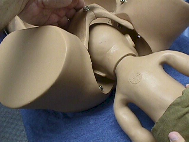 Continue to exert suprapubic pressure as the head delivers