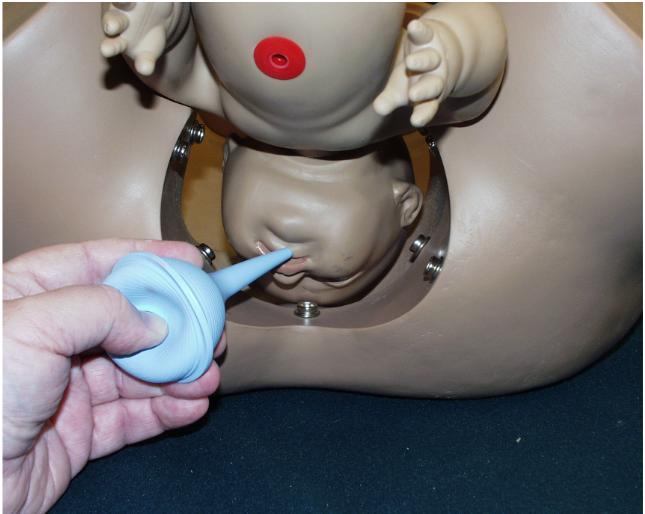 Suction the nose and mouth