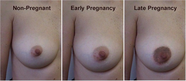 Breast changes during pregnancy