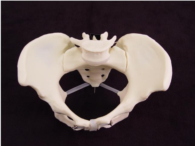 The ischial spines are boney landmarks found on deep pelvic examination of the lateral and posterior vaginal walls.