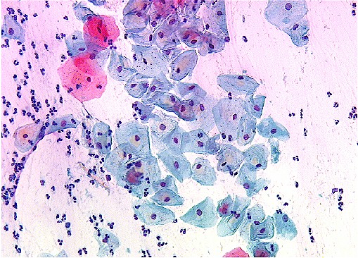 Satisfactory Pap Smear (and normal).