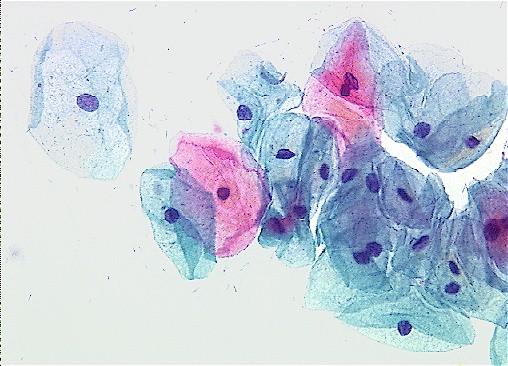 Normal Pap Smear