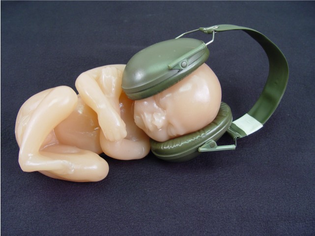 Accoustic stress on fetus