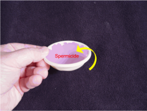 Contraceptive Diaphragm Fitting Video