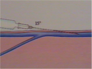 Drawing Blood Video