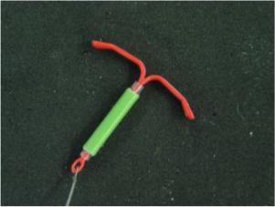 IUD Insertion Video