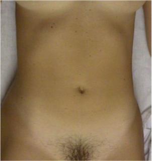 Internal Pelvic Anatomy Video