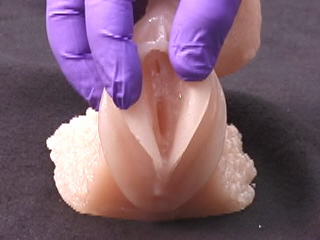 Inserting a Foley Catheter in Women Video