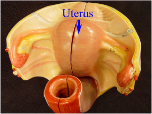 Hysterectomy Video