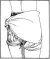fig04-36a.gif (17624 bytes)