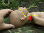 AirwayExtend_small.jpg (3050 bytes)
