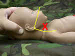 AirwayFlex_small.jpg (2934 bytes)