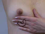 Breastcircle_small.jpg (2061 bytes)