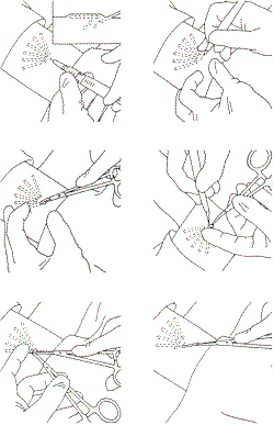 NPRemove250.gif (14304 bytes)
