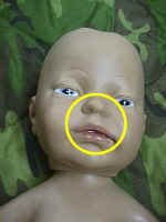 Resus_small.jpg (3990 bytes)