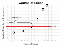 Latent phase of labor