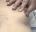 Lactation