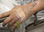 IVHand.jpg (64917 bytes)